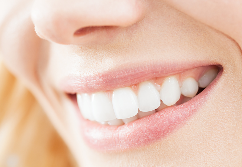 En smilende munn med hvite tenner og røde lepper.